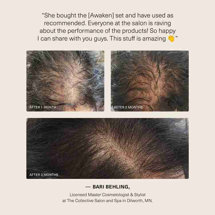 Awaken Therapeutic Hair Results by Surface