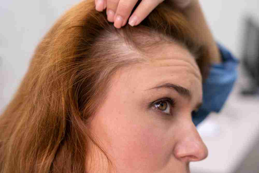 Woman noticing her hairline is thinning